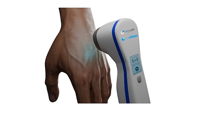 &Uuml;niversite &ouml;ğrencisi babasının hastalığından yola &ccedil;ıkarak vitiligo tedavisi i&ccedil;in cihaz geliştirdi